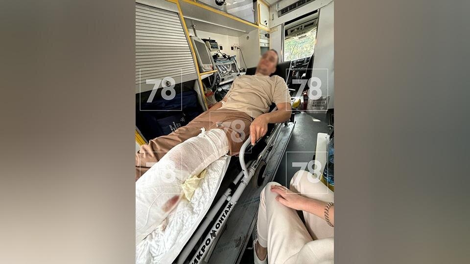 КОНСТАНТИН БЕЛОЗЁРОВ С ПРОСТРЕЛЕННОЙ НОГОЙ. Открытый источник.