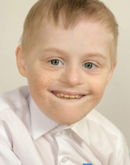 «Солнечное» счастье есть и он ждет родителей уже очень давно!