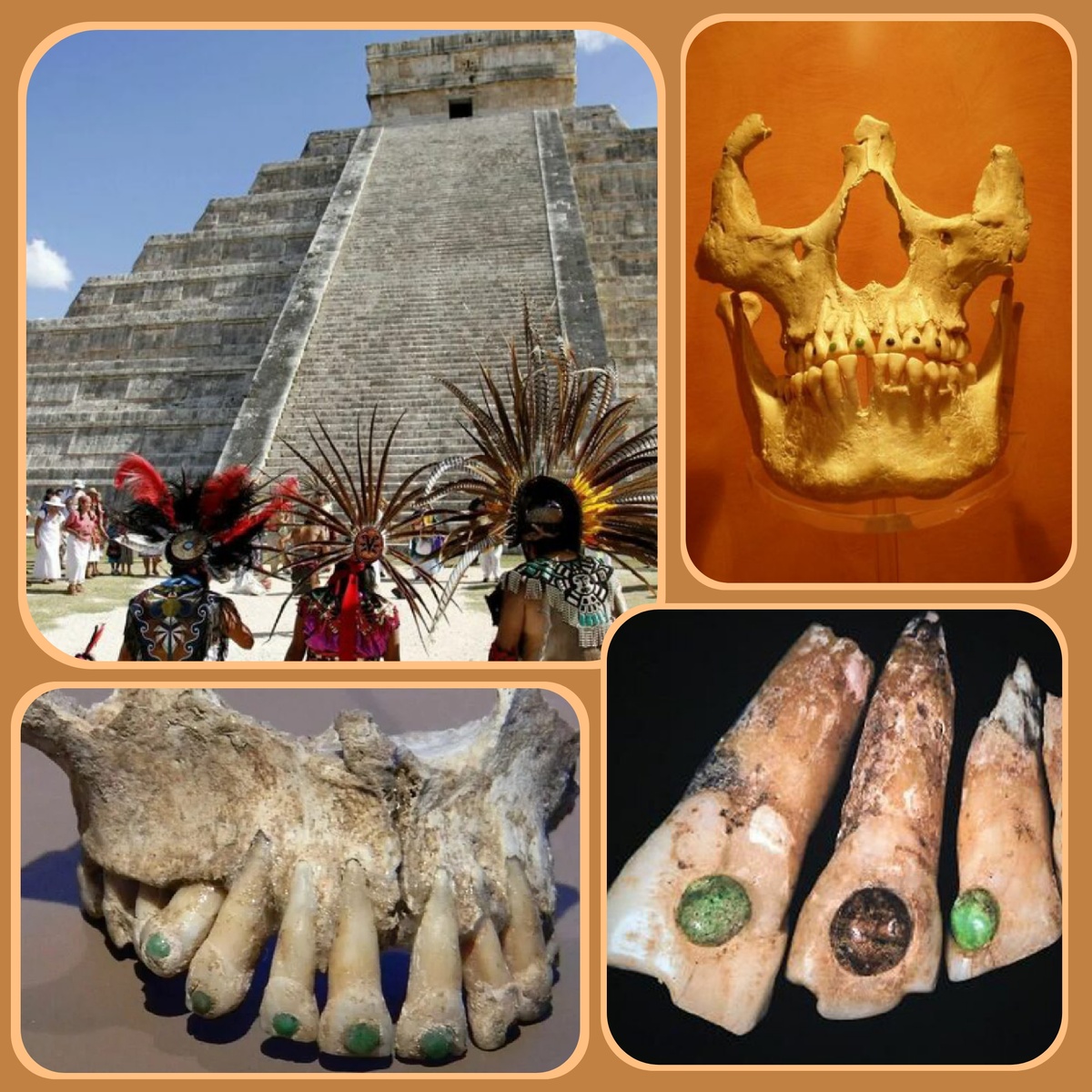 Индейцы майя инкрустировали зубы драгоценными и поделочными камнями. В ход шли жемчуг, лазурит, турмалин, яшма и др.