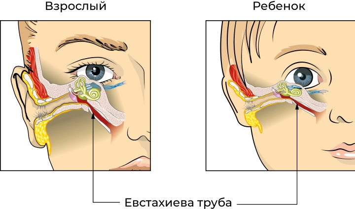 У детей слуховая труба прямая и короткая, что приводит к частому распространению инфекции из носа в уши.