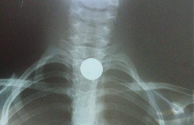    Фото: mz.mosreg.ru Анфиса Слепцова