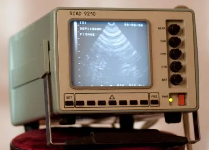 История создания УЗИ-аппарата