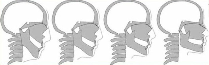 формирование лицевой стороны черепа при мьюинге
