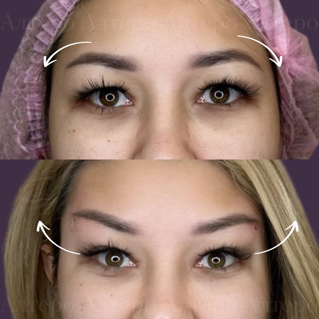 На фото работы пластического хирурга Авагян А.В.