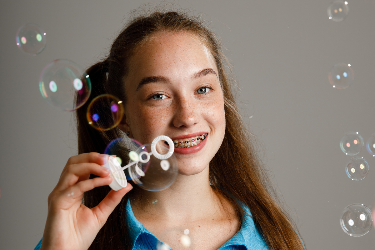 Самовыражение за счёт брекетов: почему бы и нет?