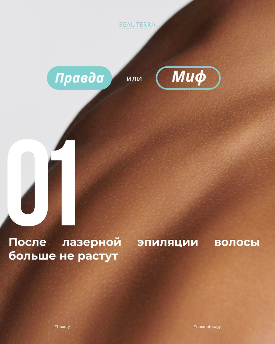Лазерная эпиляция в клинике Бьютерра