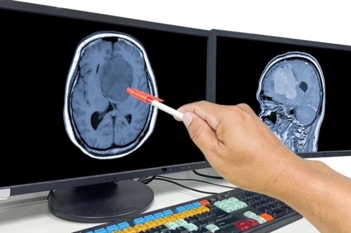    Средство для борьбы с раком мозга создали учёные из Новосибирска