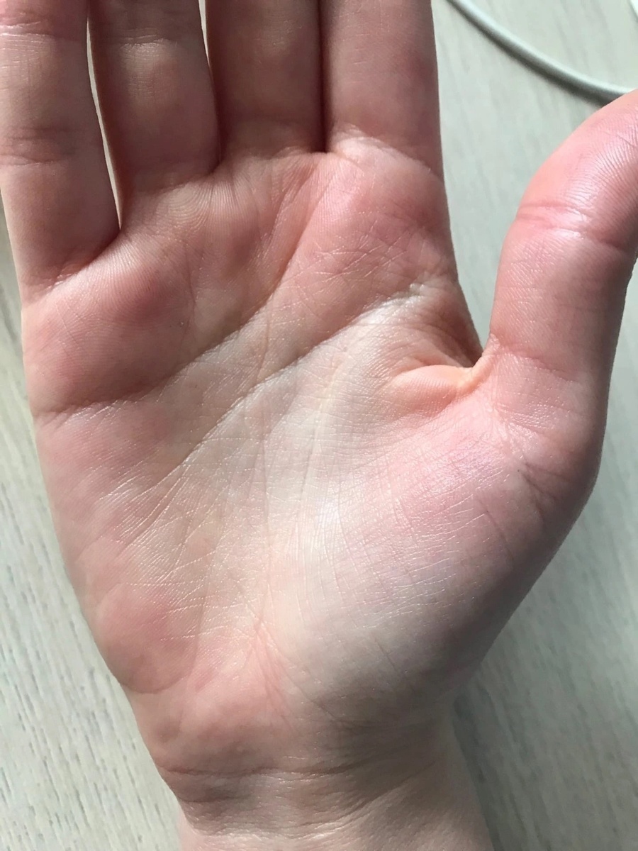 Много мелких линий на ладони