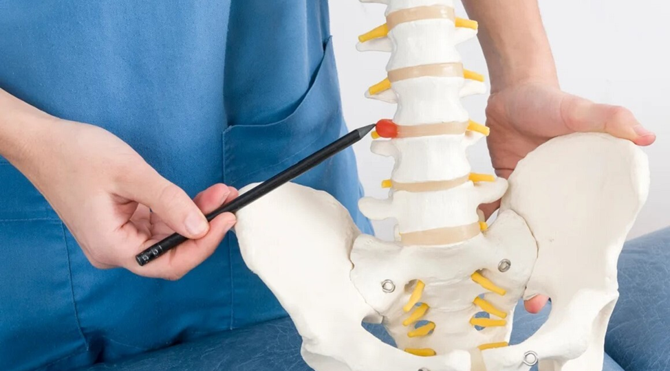 Межпозвоночная грыжа — что это, почему возникает и как лечить?
