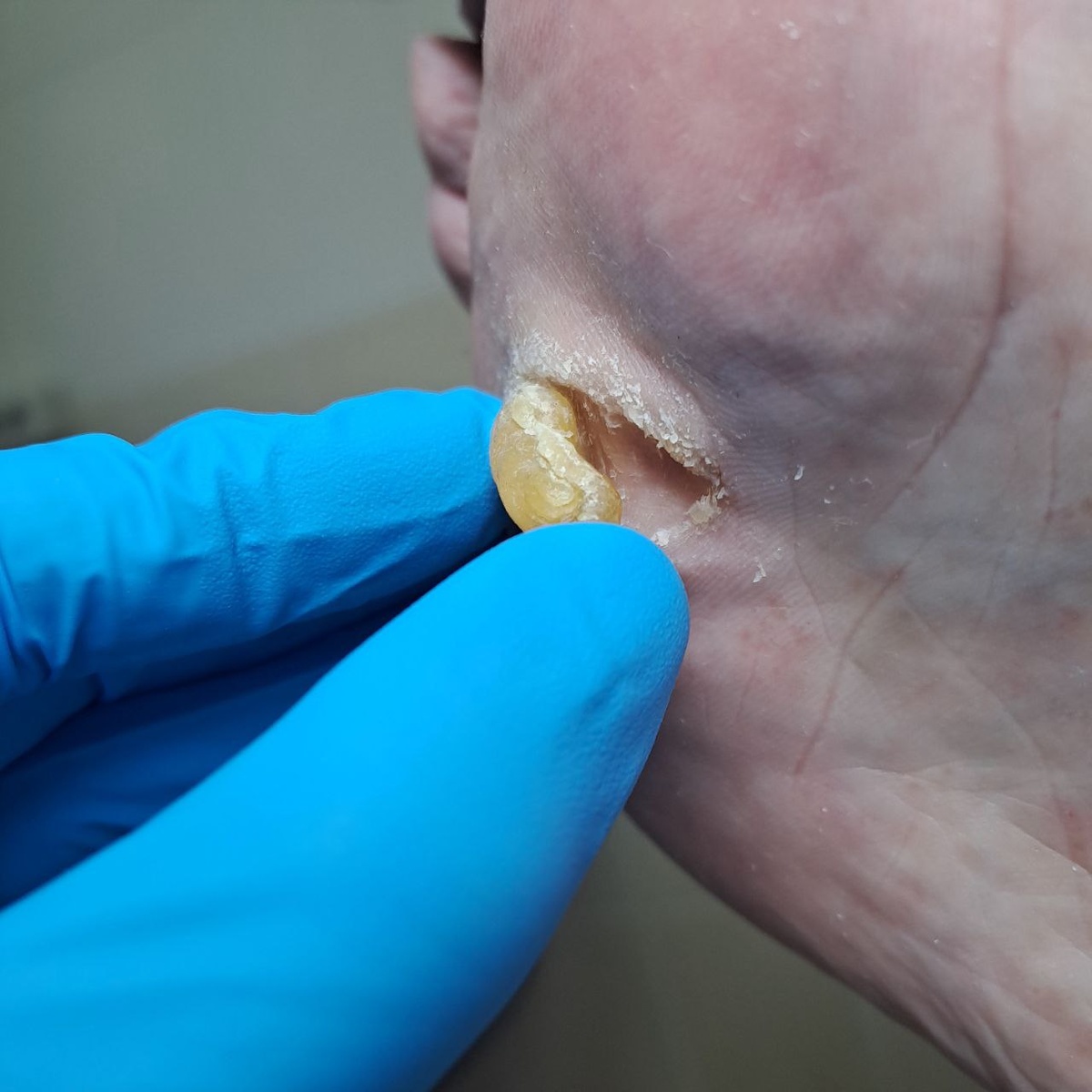 Вид сбоку, выгладит как ноготь