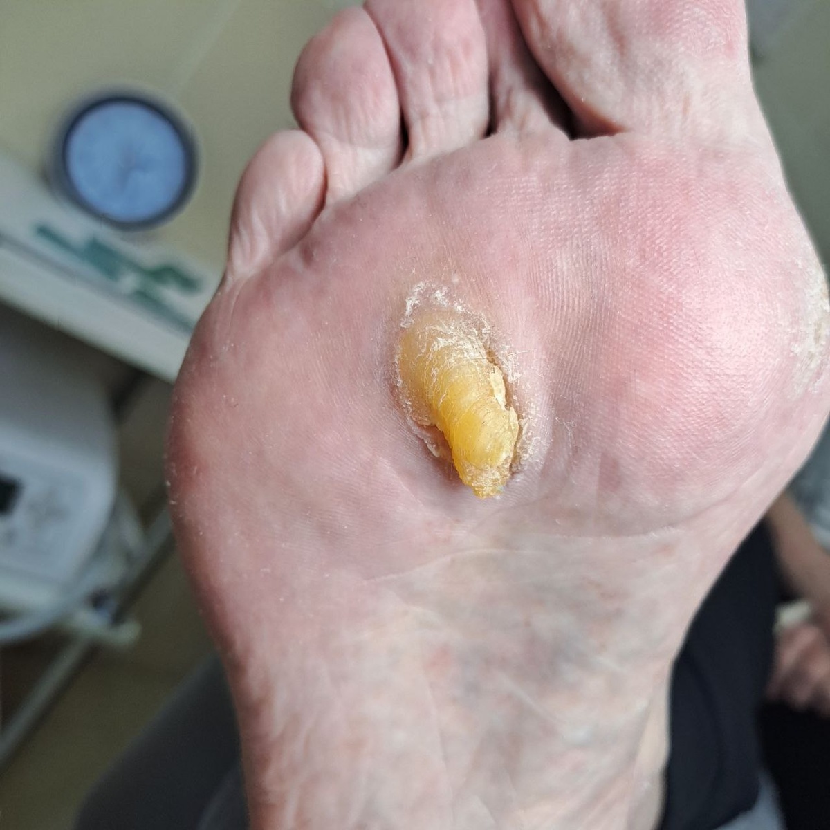 Вид со стопы