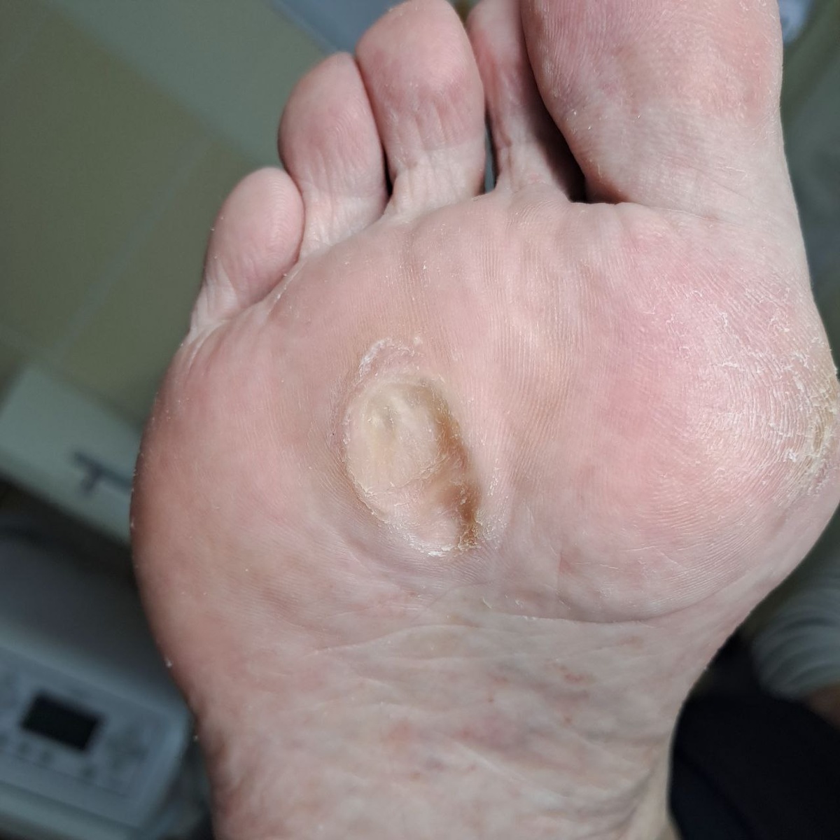 Окончательный результат после обработки подологом