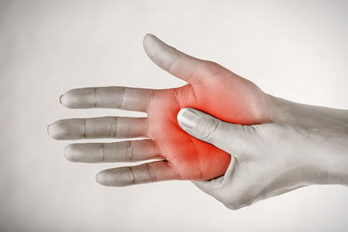 место боли при синдроме капального канала