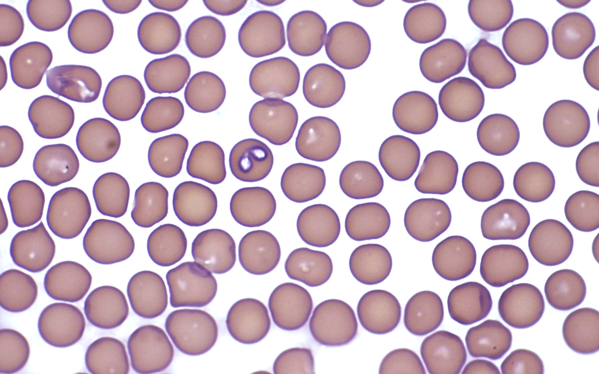 Споровики Babesia Bovis