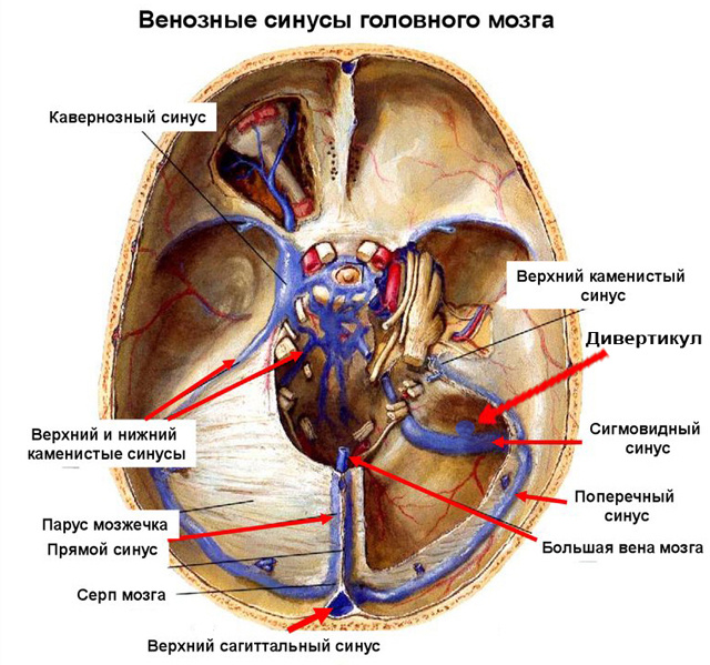 Схематичное расположение синусов в мозге 