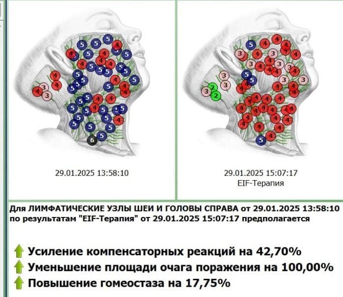 Диагностика с коррекцией состояния в программе Дианел