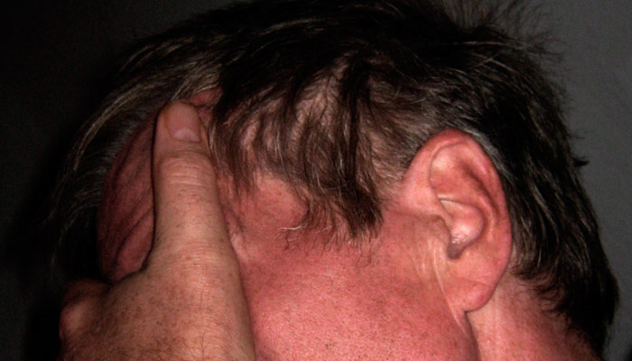 Метеочувствительные люди должны быть готовы к приходу геомагнитной бури. Фото: pxhere.com