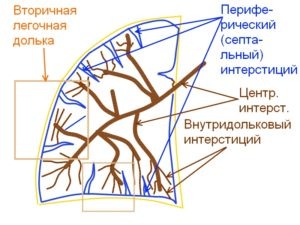 Вторичная легочная долька является наименьшей структурной единицей лёгкого, окружённая интерстицием 