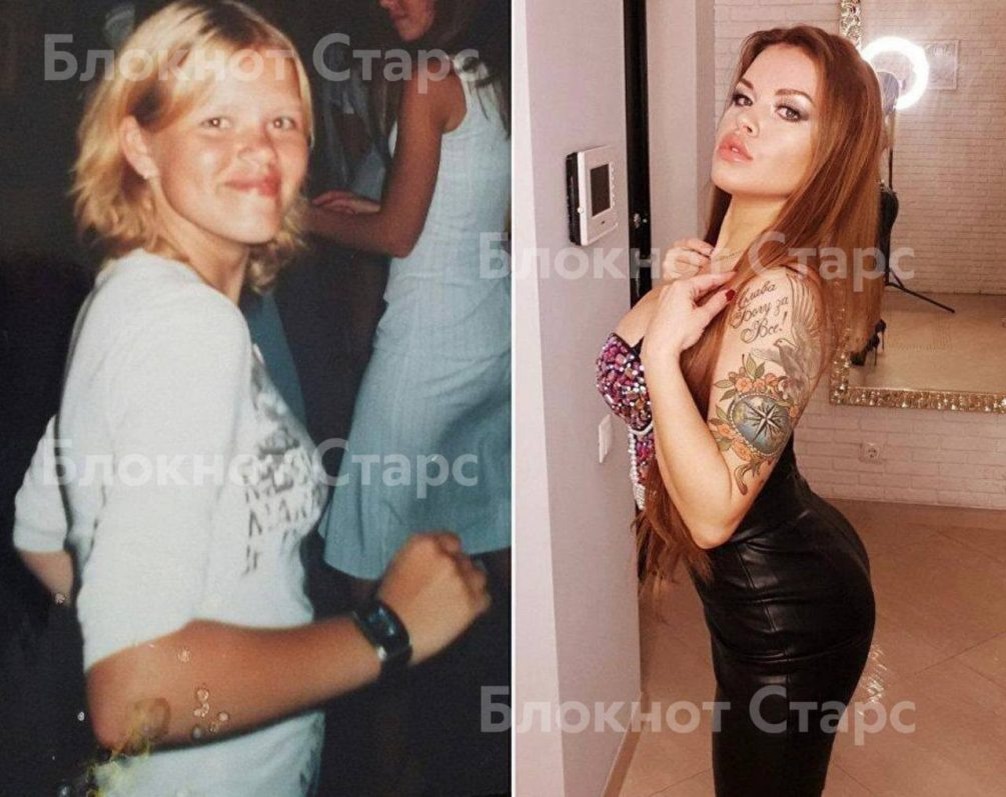   Олеся Малибу до и после пластики. Фото: соцсети и открытые источники