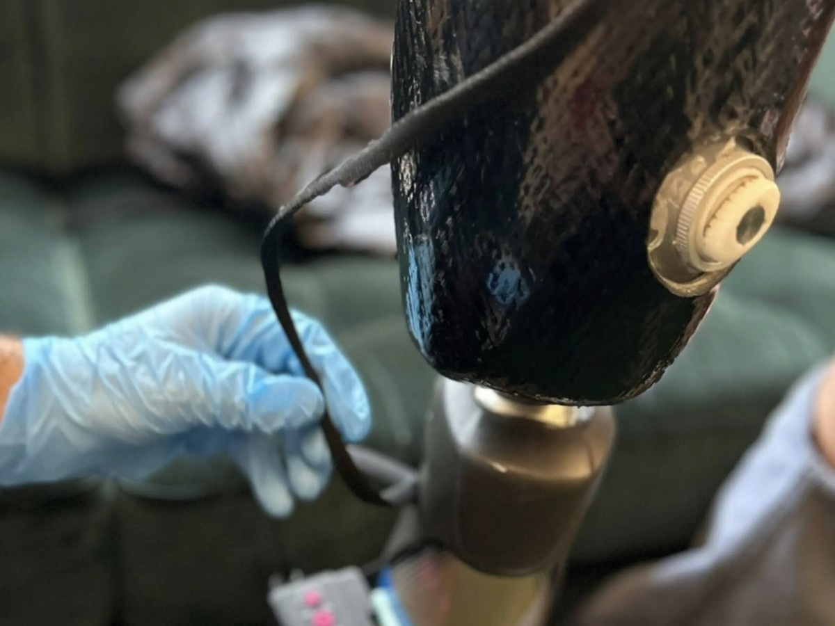    Умная подкладка для протезов Roliner подстраивается под живую ткань [ВИДЕО]