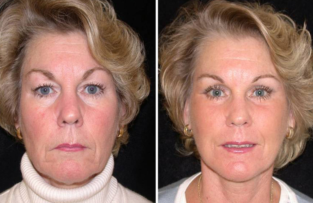    Клиника долголетия КГБ и ее тайны: как элита продлевает жизнь