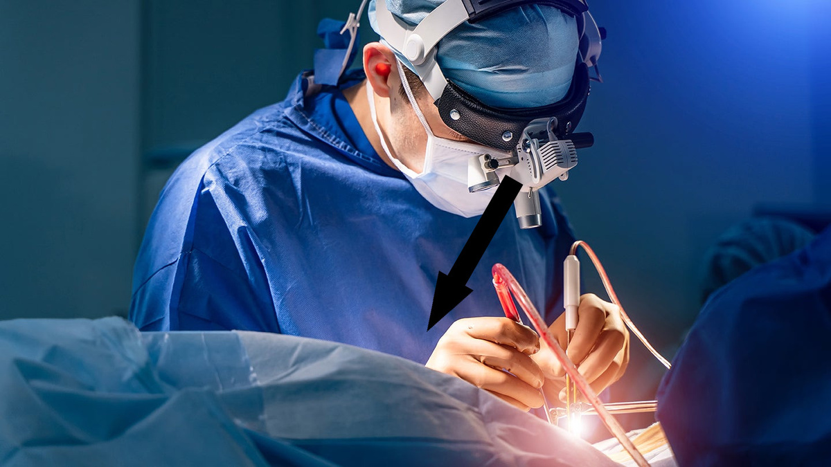    Нейрохирургия Гульельми: Как операции проходят без анестезии?