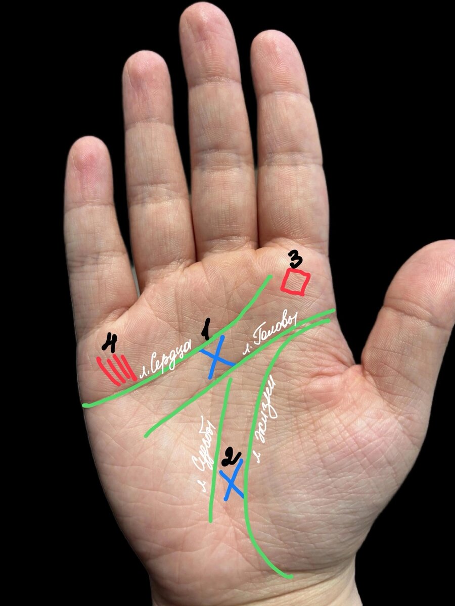 Номер 1. Крест Учителя = Мистический крест. Номер 2. Крест Самаритянина = Крест Святого Андрея. Номер 3. Квадрат Учителя. Номер 4. Линии добрых самаритян (медицинских стигматов).