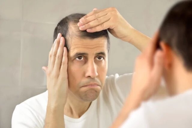    От каких напитков у мужчин могут выпадать волосы?