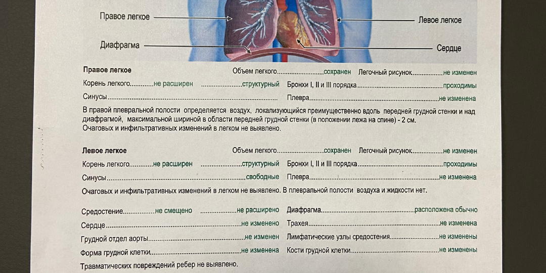 Правосторонний спонтанный пневмоторакс. 1 случай - часть 1