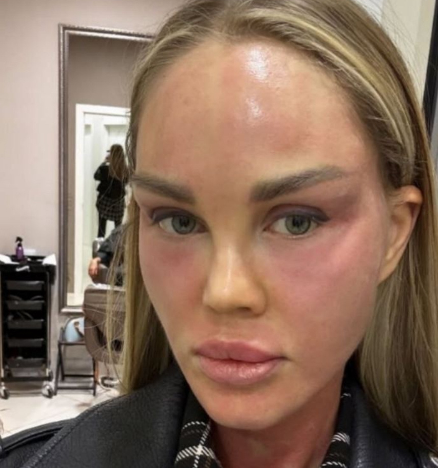 Соцсети Погребняк 