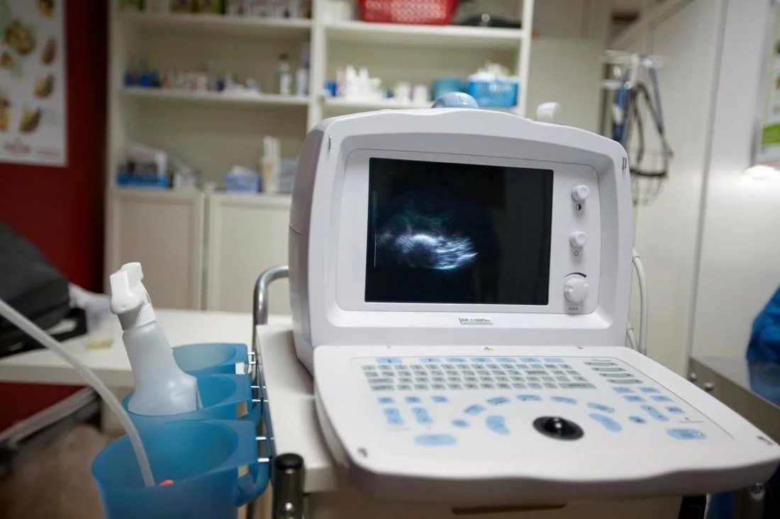    Тайные войны: Как советские УЗИ-аппараты стали оружием шпионажа