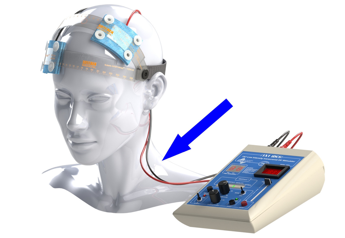    Нейростимуляторы, возвращающие зрение: новые горизонты или научная фантастика?