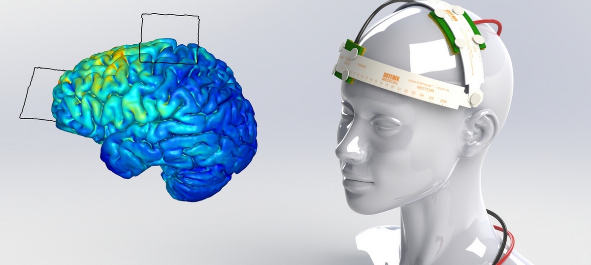    Нейростимуляторы, возвращающие зрение: новые горизонты или научная фантастика?