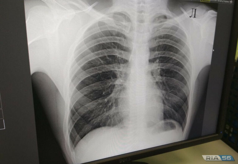    Роспотребнадзор: В Оренбуржье снижается заболеваемость туберкулезом Белов Михаил Александрович