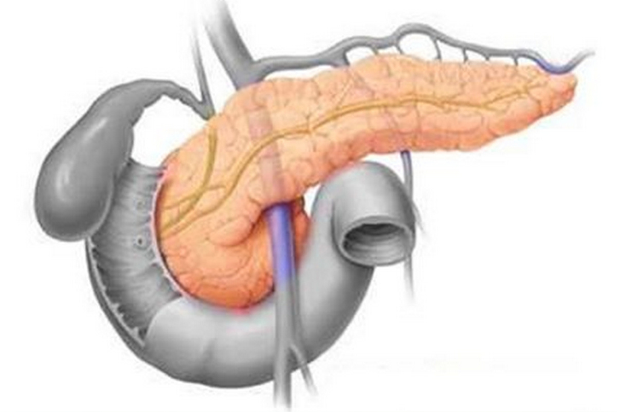    Инсулин-М: Как Искусственная Поджелудочная Железа Меняет Жизни