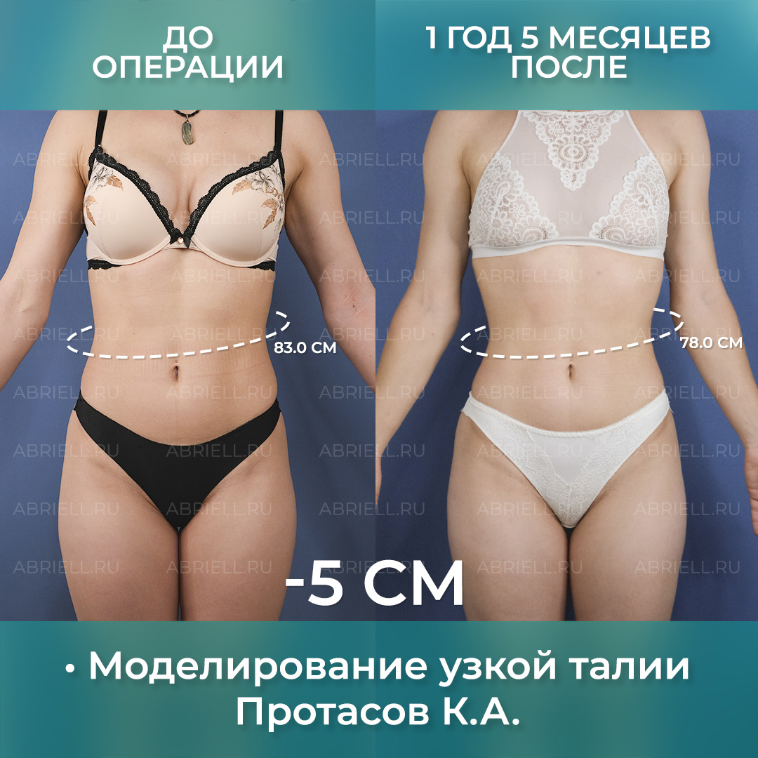 Хирург: Протасов К.А.