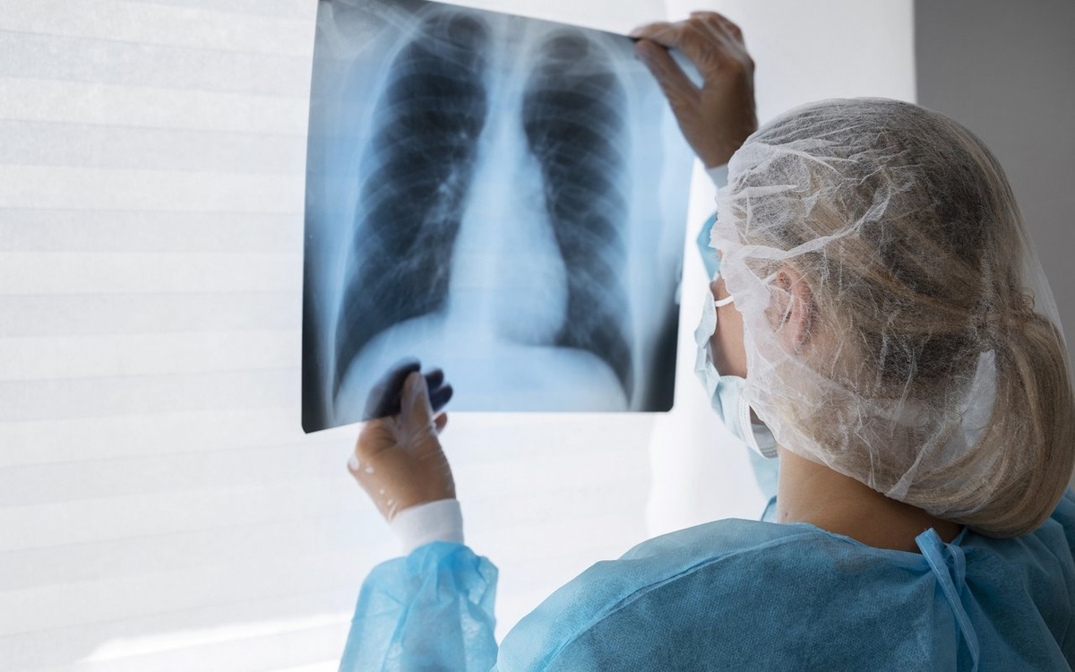    В Липецкой области в прошлом году туберкулез впервые выявлен у 132 человека Freepik