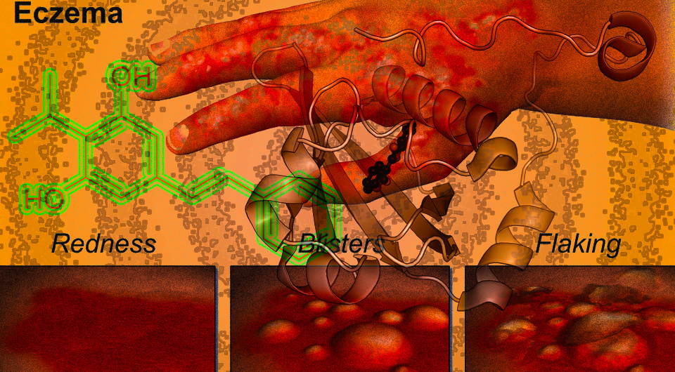   N + 1; BruceBlaus / Wikimedia Commons / CC-BY-SA-4.0; Synpath / Wikimedia Commons / CC0; Ed (Edgar181) / Wikimedia Commons / Public Domain