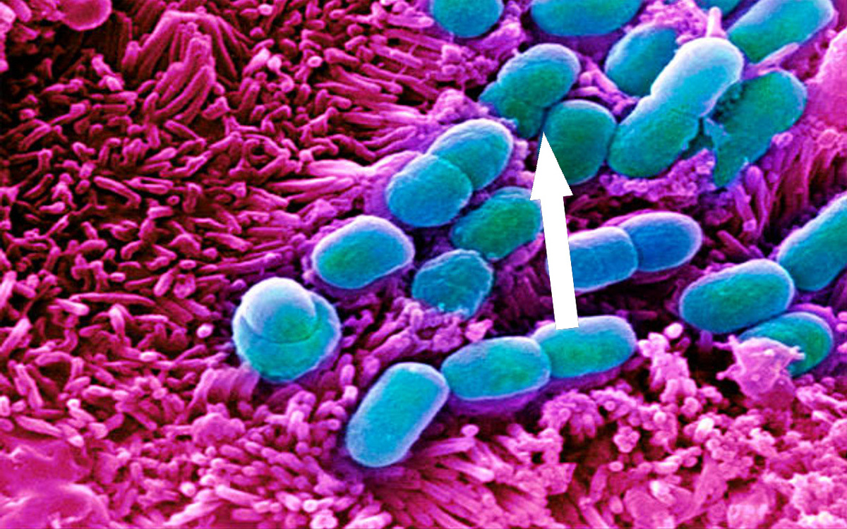    Микробы, которые могли бы изменить историю: Советские диверсанты в мире бактерий