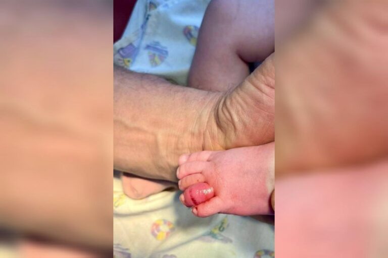    В Орске выпавший волос матери чуть не лишил пальца младенца Андрей Севостьянов
