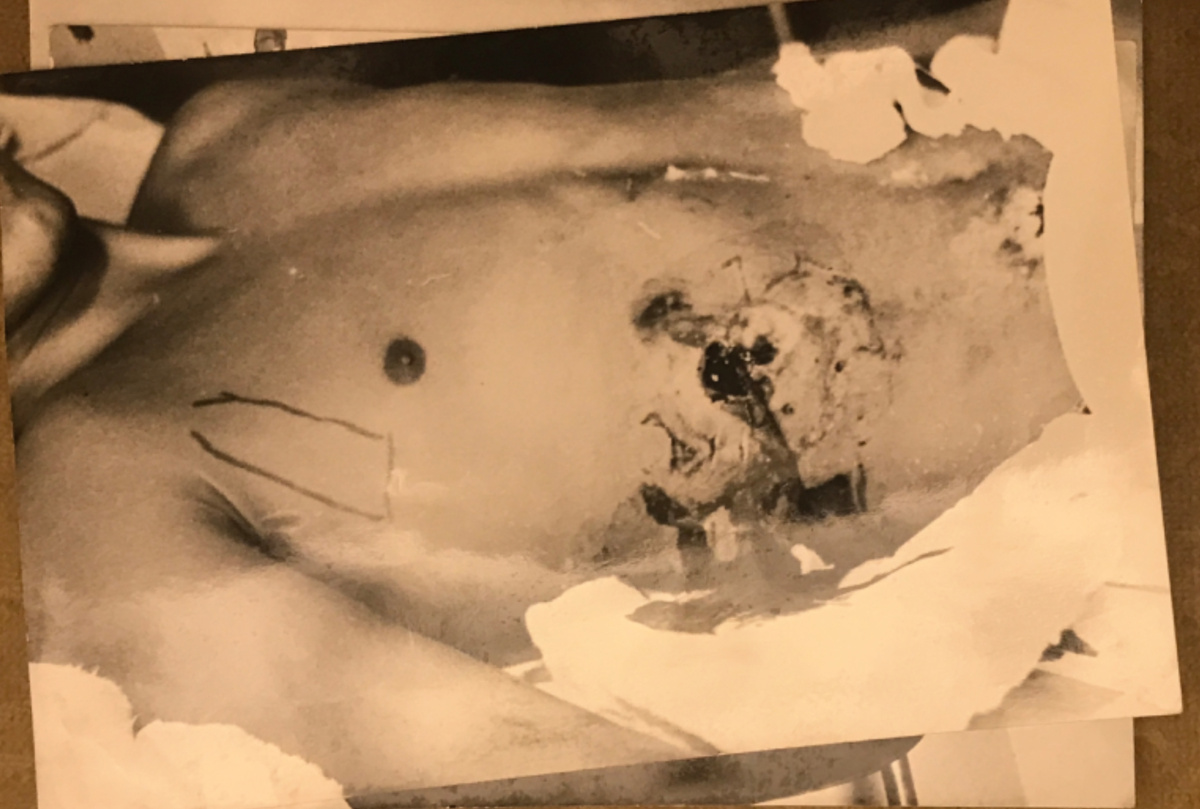 Подготовка к операции