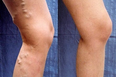 Змеетоник ВЕНО+