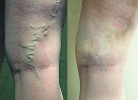 Змеетоник ВЕНО+