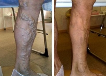 Змеетоник ВЕНО+