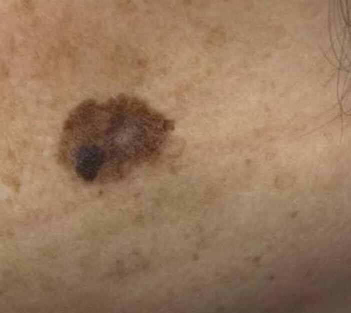 Источник фото: vk.com/minzdravrostov