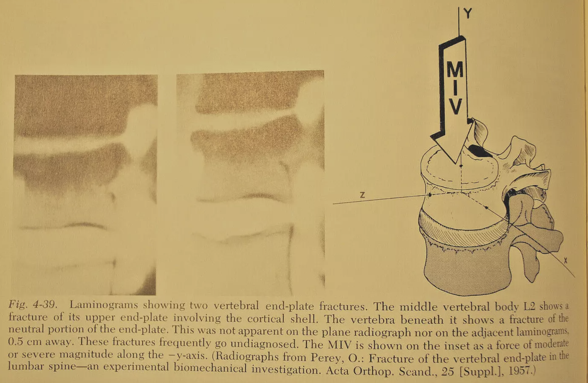 Клиническая биомеханика позвоночника Манохара Панджаби и Августа А. Уайта III 