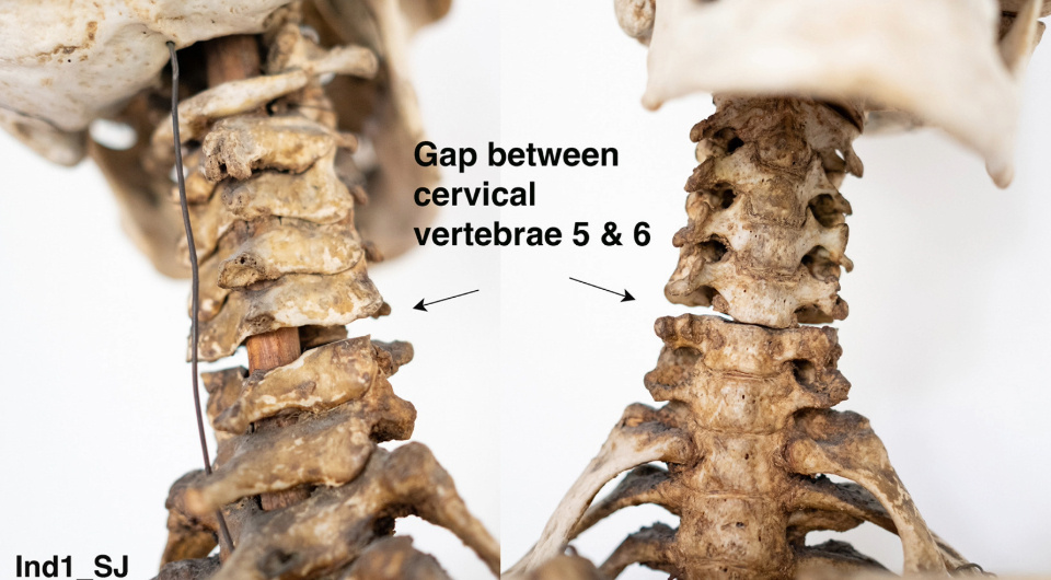  Walter Parson et al. / Forensic Science International: Genetics, 2025