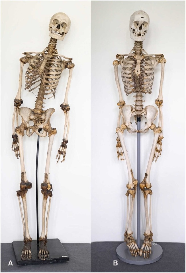   Walter Parson et al. / Forensic Science International: Genetics, 2025