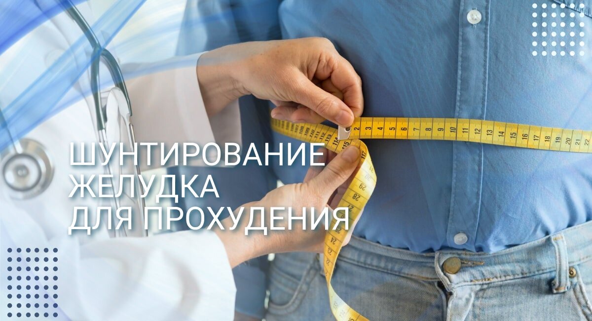 Шунтирование желудка для похудения в Махачкале