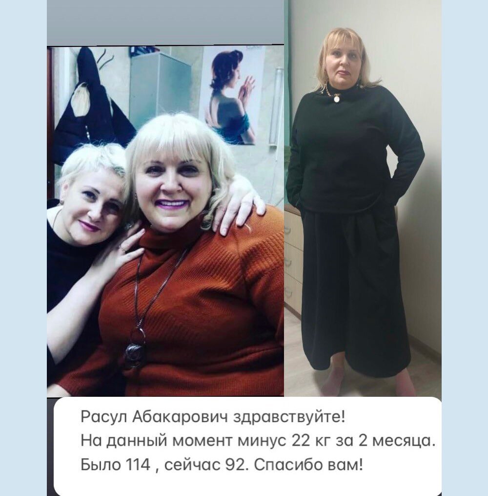 Отзыв после бариатрической операции шунтирования